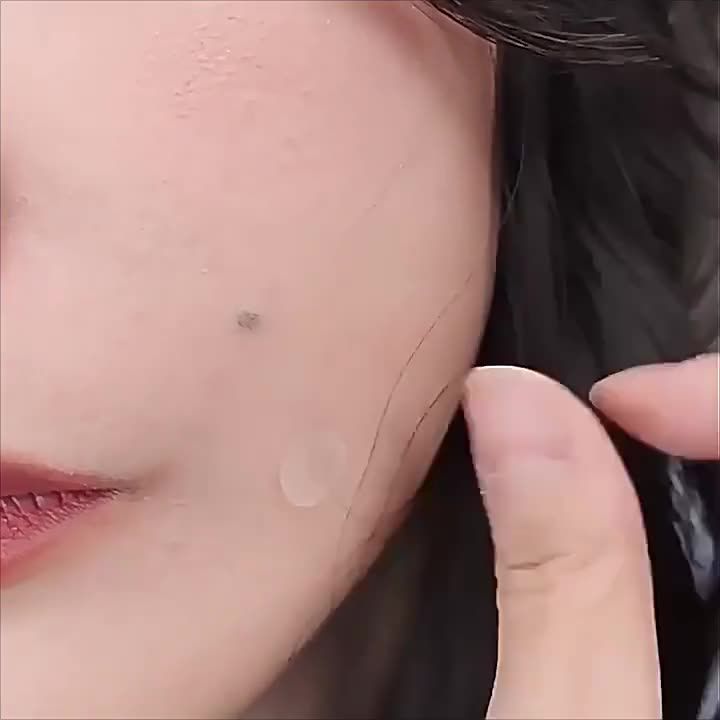 12Counts Pimple Patches for Face emoji Hydrocolloid Acne Patches for face Invisible Zit Patches for Face Pimple Patch Acne Spot Treatment Patch Blemish Patches Cover Patches Stickers