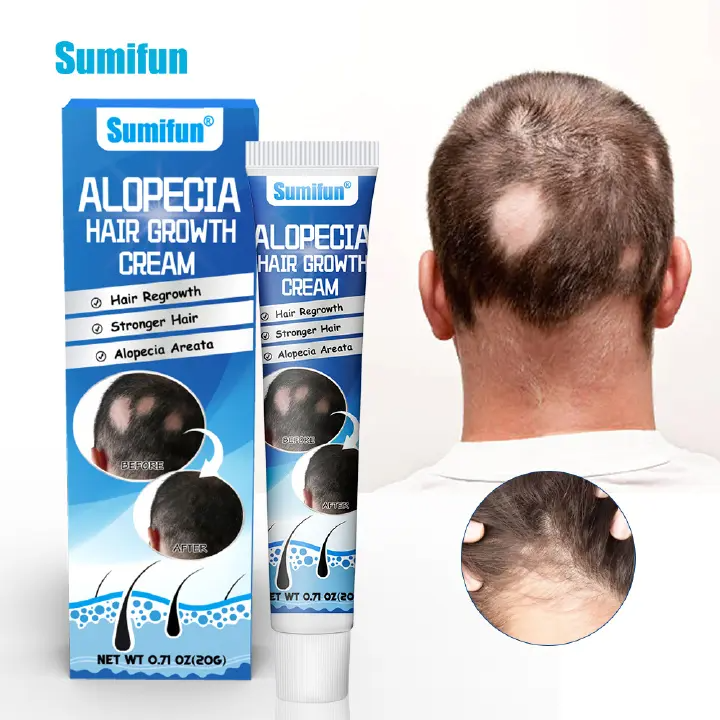 Alopecia Areata Hair Care Cream Hair Follicle Health Care Ointment Scalp Care Herbal Cream