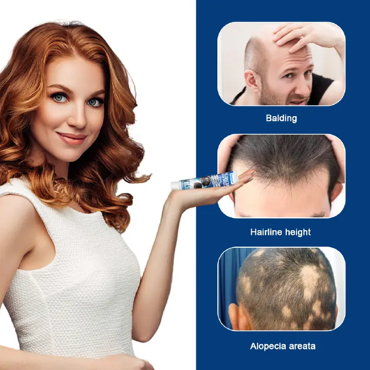 Alopecia Areata Hair Care Cream Hair Follicle Health Care Ointment Scalp Care Herbal Cream
