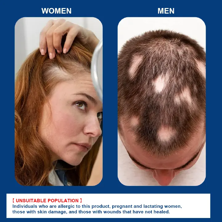 Alopecia Areata Hair Care Cream Hair Follicle Health Care Ointment Scalp Care Herbal Cream
