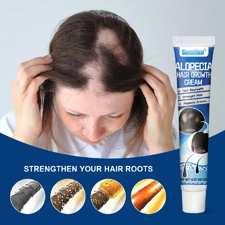 Alopecia Areata Hair Care Cream Hair Follicle Health Care Ointment Scalp Care Herbal Cream