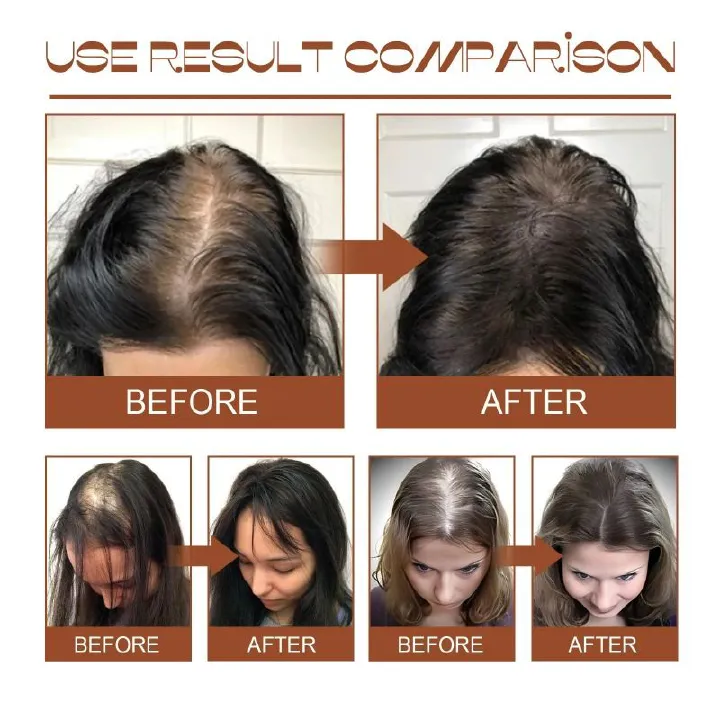 Natural 100% Pure Batana Oil Butter Hair Mask Anti Break Loss Hair Growth From Honduras Hair Loss Treatment For Black Men Women