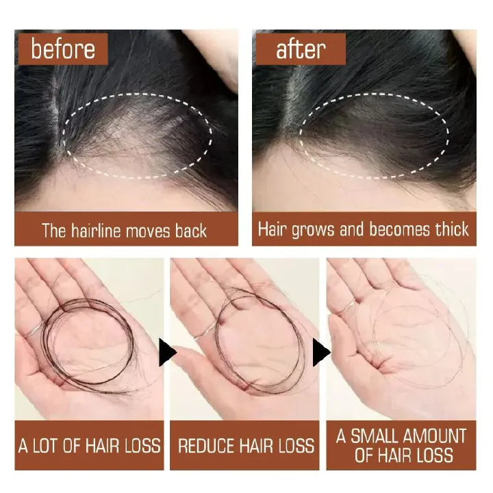 Natural 100% Pure Batana Oil Butter Hair Mask Anti Break Loss Hair Growth From Honduras Hair Loss Treatment For Black Men Women