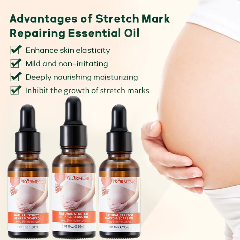 Stretch Marks Remover Skincare Body Oil Serum, Face and Body Moisturizer for Scars, Stretch Marks, Scars Repair, Abdominal Firming, and Gentle Stretch Marks Eradication All Skin Types - KORMESIC -