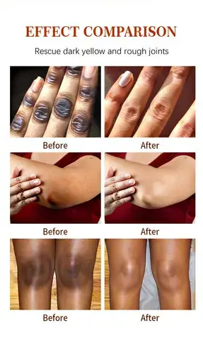 Dark Knees and Elbows Lightening Cream Body Whitening Cream