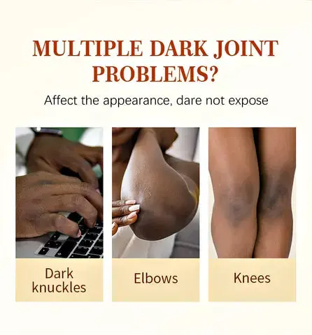 Dark Knees and Elbows Lightening Cream Body Whitening Cream