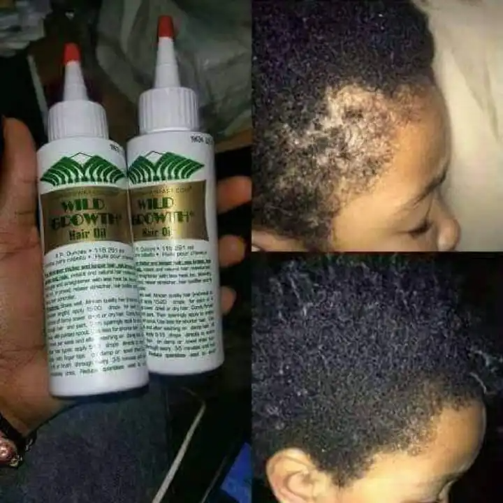 Wild Growth Hair Growth Oil