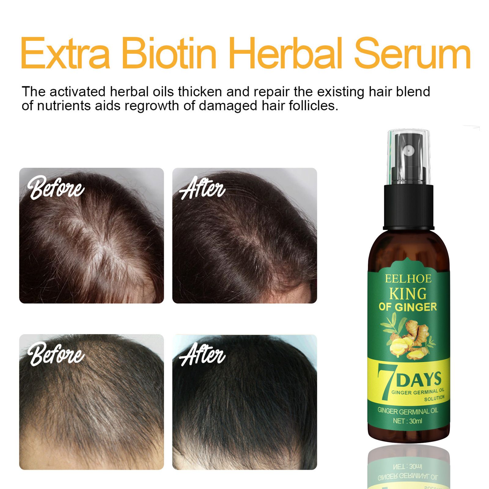 EELHOE  Ginger Hair Growth Serum Sprayer Hair Regrowth s Grow Thicker Longer Hair Accelerate Growth For Men And Women