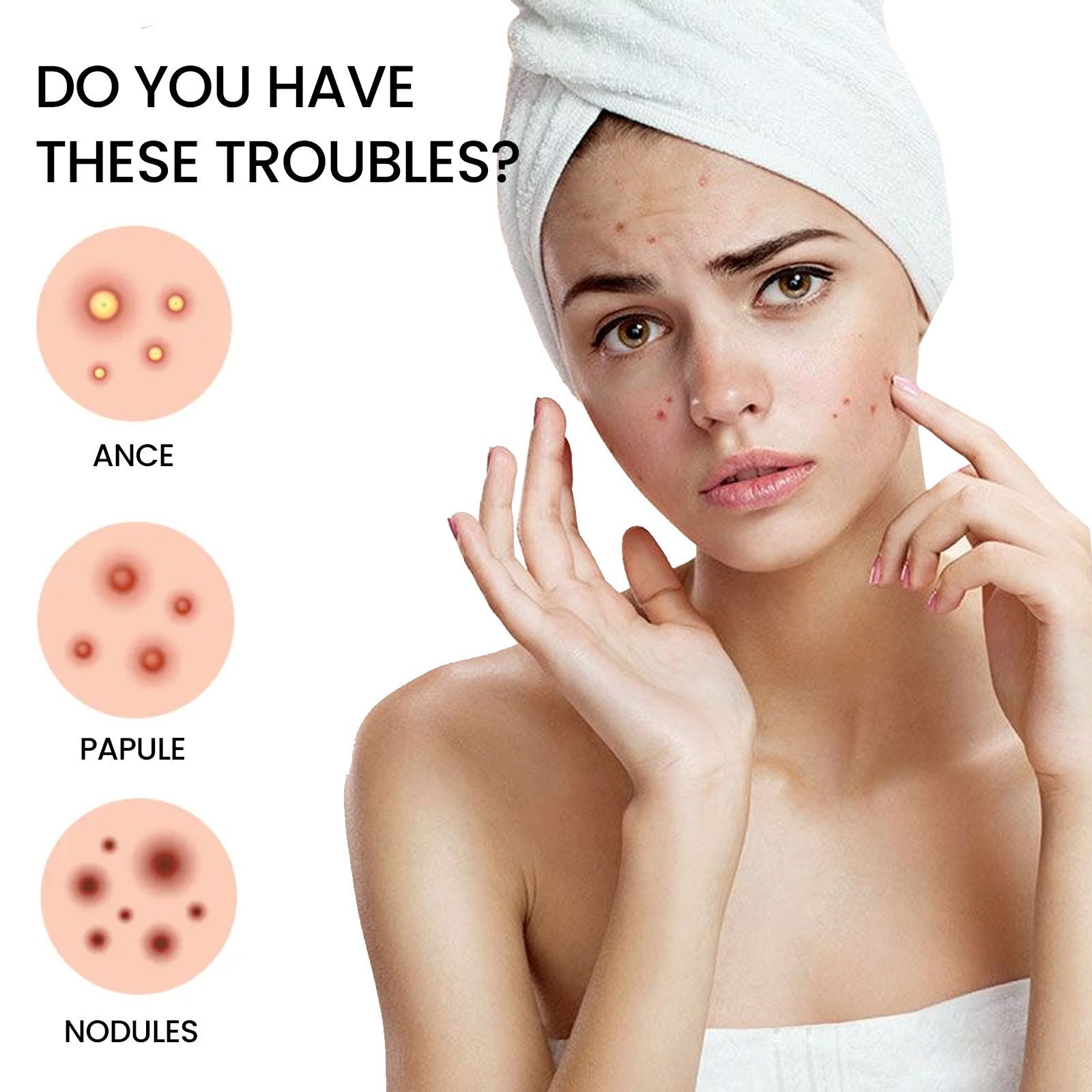 200pcs Repair Acne Patch Facial Skin Care Fade Blemishes Pimple Marks Closed Acne Blemishes Cover Acne Pimple Repair Patch