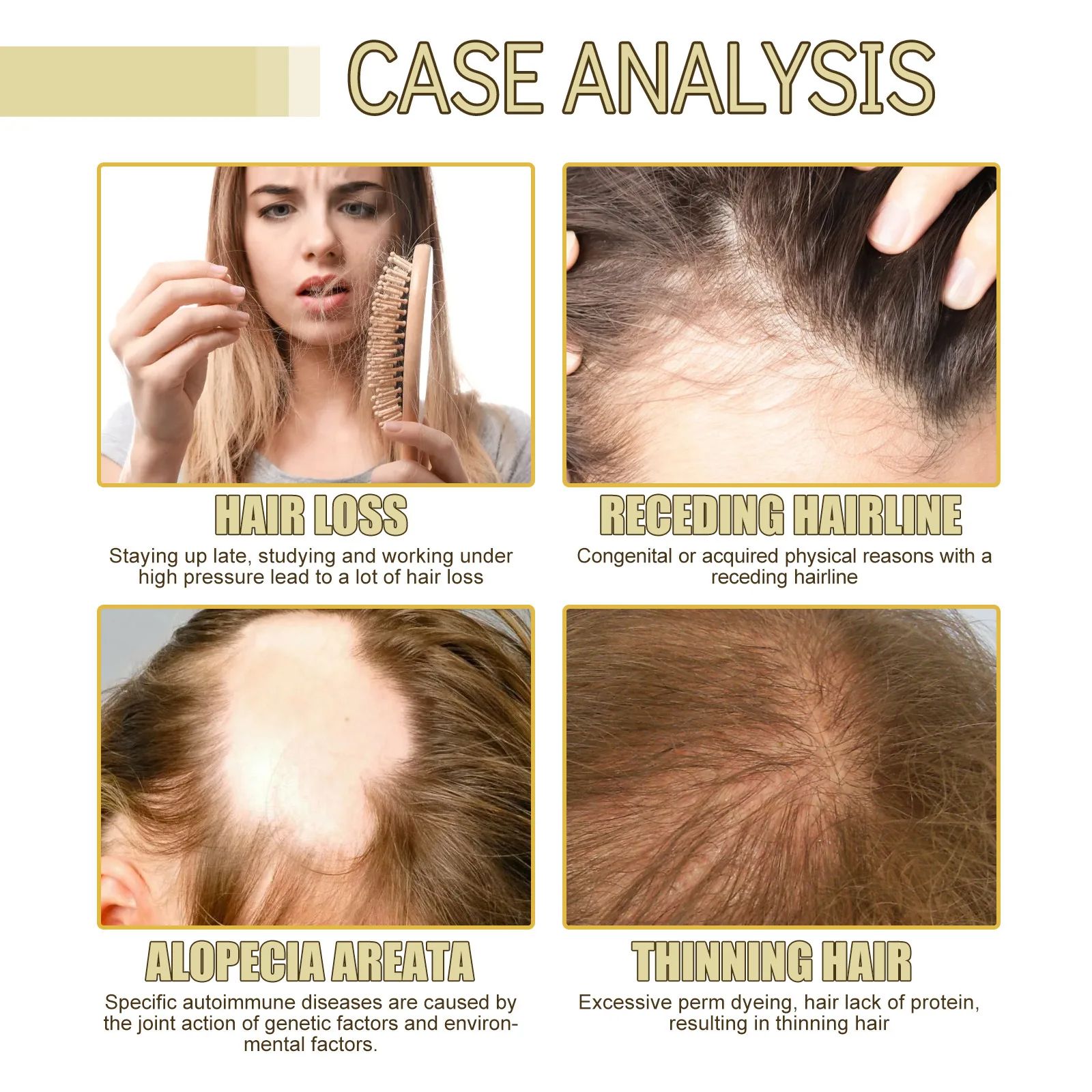 EELHOE Rosemary Hair Tightening Essential Oil Repair Damage Prevent Loss Smooth Hair Nourish Hair Hair Care Oil Bridesmaid Gift 60ml
