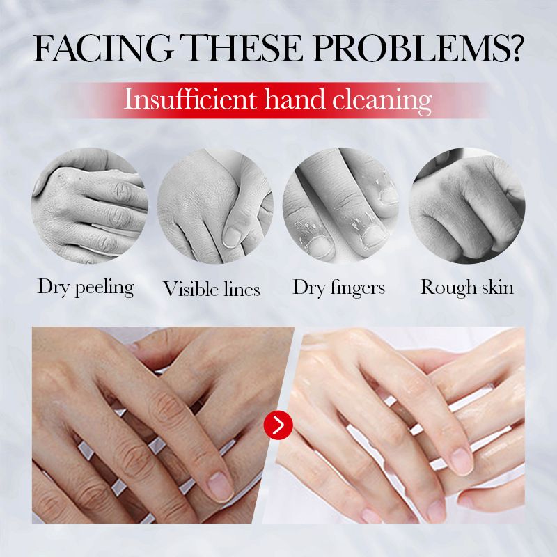 Fade Dullness Hand Cream Anti-wrinkle Remove Cracked Lotion Body Fast Lighten Black Skin Brighten Smooth Nourish Moisturizer 30g