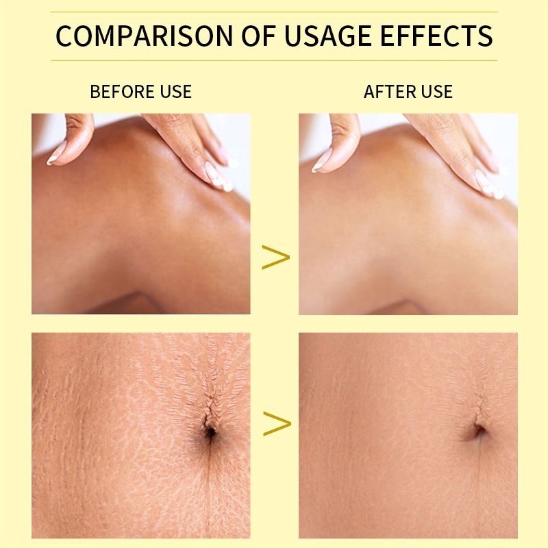 Body Care Exfoliating Yellow Peeling Oil 100% Organic Bleaching Dark Skin Serum Dark Knuckles Fast Body Skin Care Oil 110ml