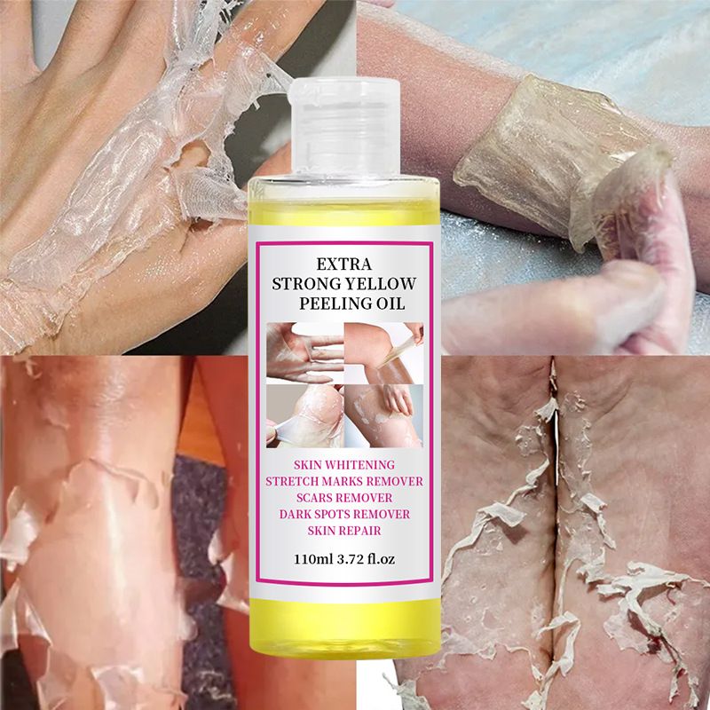 Body Care Exfoliating Yellow Peeling Oil 100% Organic Bleaching Dark Skin Serum Dark Knuckles Fast Body Skin Care Oil 110ml