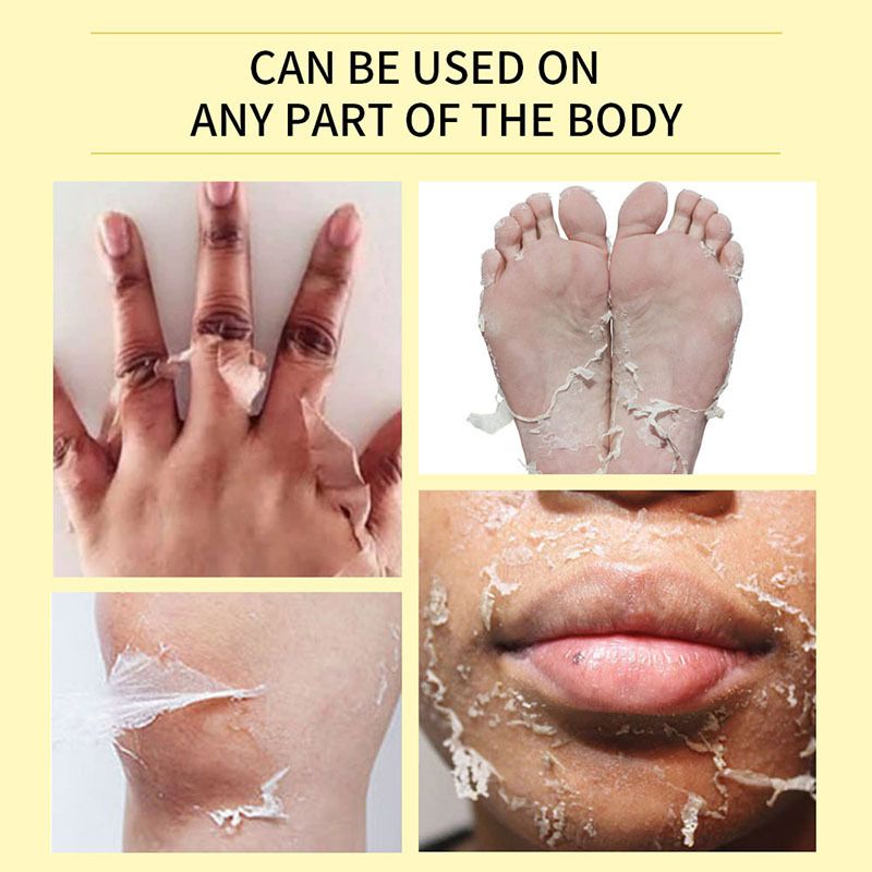 Body Care Exfoliating Yellow Peeling Oil 100% Organic Bleaching Dark Skin Serum Dark Knuckles Fast Body Skin Care Oil 110ml