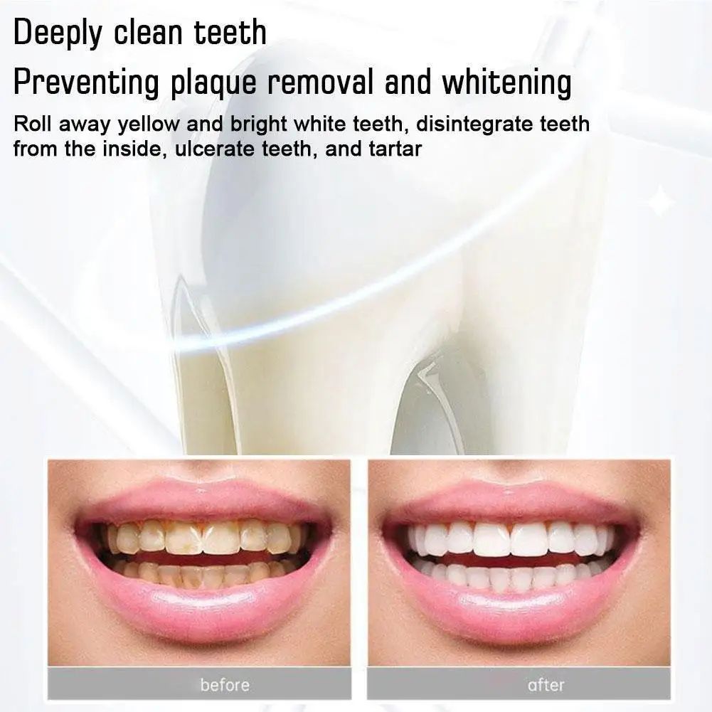 Probiotic Caries Toothpaste SP4 Whitening Repair Tooth Decay Paste Cleaner Teeth Remover Plaque Fresh Breath Oral Care
