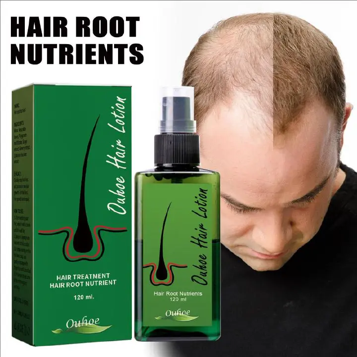 OUHOE  Hair Lotion Hair oil hair serum hair grow Treatment Spray 100% Original 120ml Made In Thailand Essence Oil Hair Loss for Men