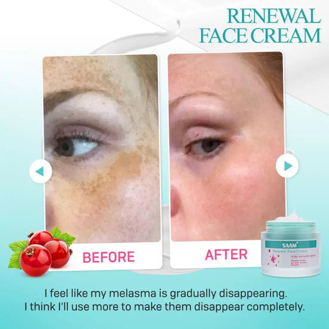 Trending Bestseller SAAM Renewal Face Cream for Melasma Age Spots Hyperpigmentation Sunburn Red Face Reveal Brighter Even Toned Radiant Skin
