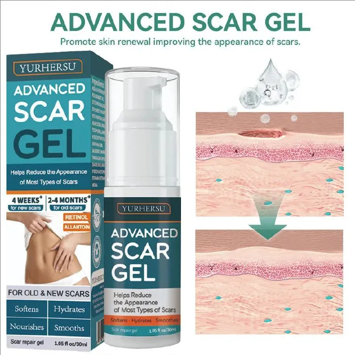 Advanced Recovery Scar Cream Fast Removal Skin Scars Treat Surgery Scars Stretch Marks Acne Pox Prints Burn Repair Gel