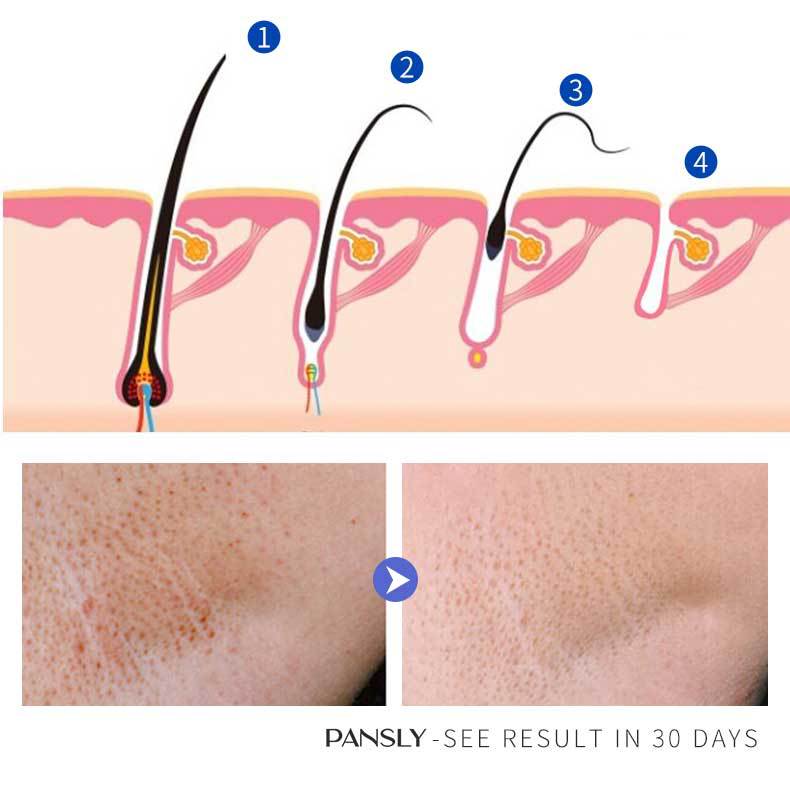 Hair Removal Inhibitor Cream Permanent Hair Regrowth Inhibitor Painless for Beard Bikini Intimate Legs Body Armpit Smooth Skin