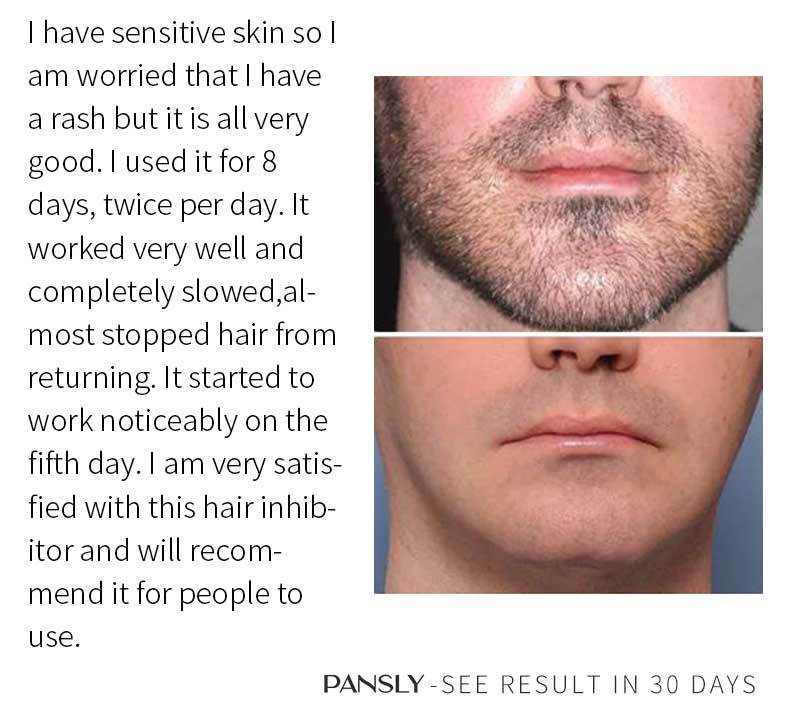 Hair Removal Inhibitor Cream Permanent Hair Regrowth Inhibitor Painless for Beard Bikini Intimate Legs Body Armpit Smooth Skin