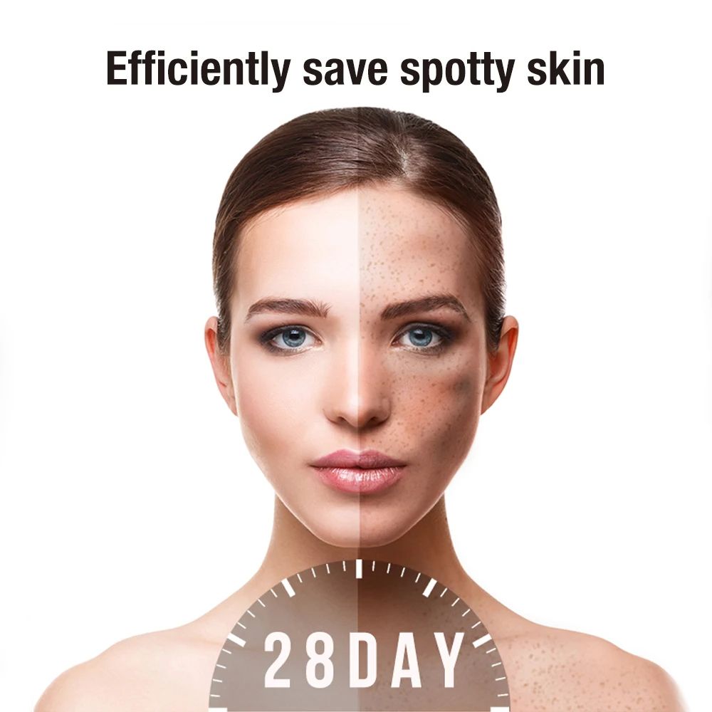 Whitening Freckles Cream Dark Spot Lightening Melanin Removal Melasma Remover Moisturize Brighten Face Skin Care 20g