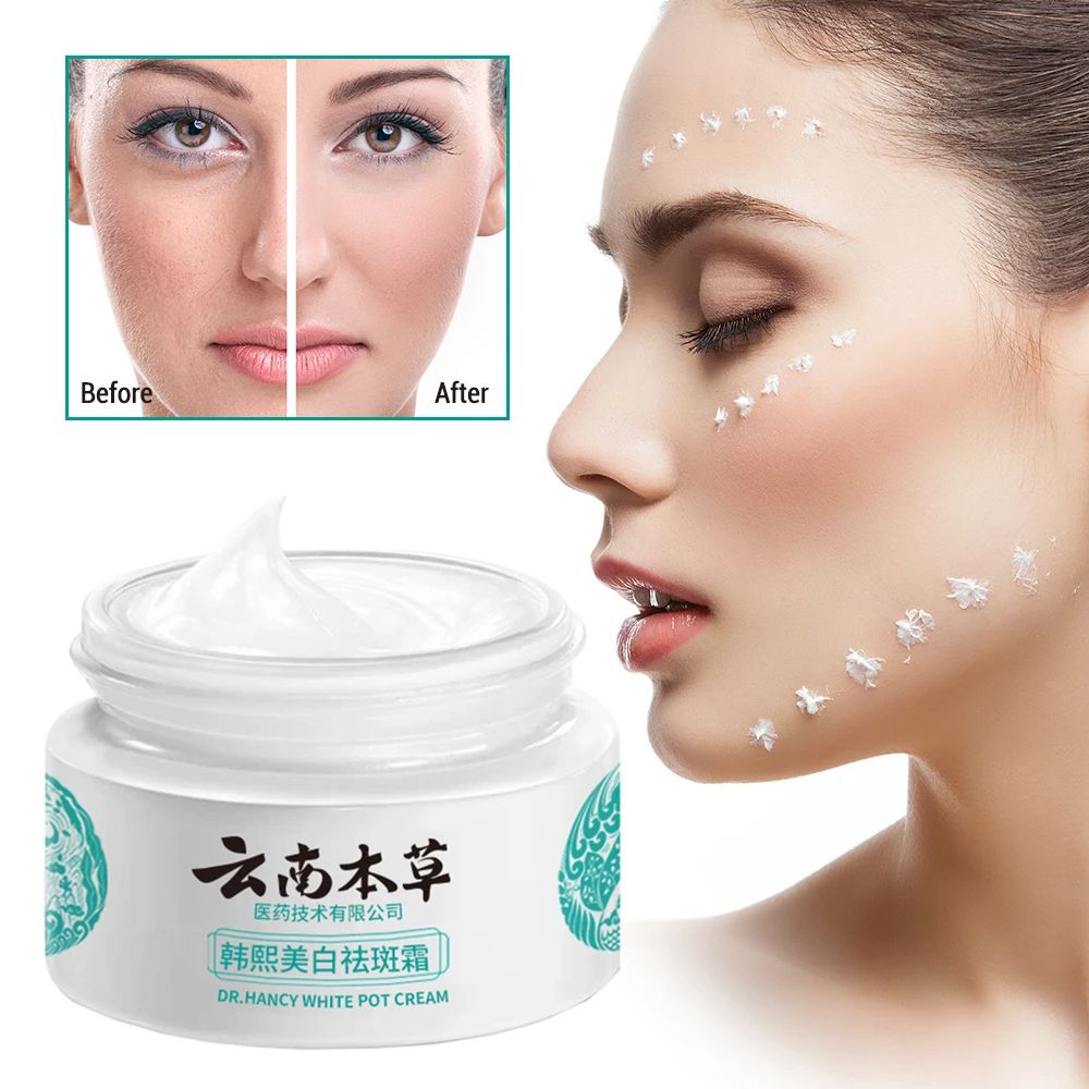 Whitening Freckles Cream Dark Spot Lightening Melanin Removal Melasma Remover Moisturize Brighten Face Skin Care 20g