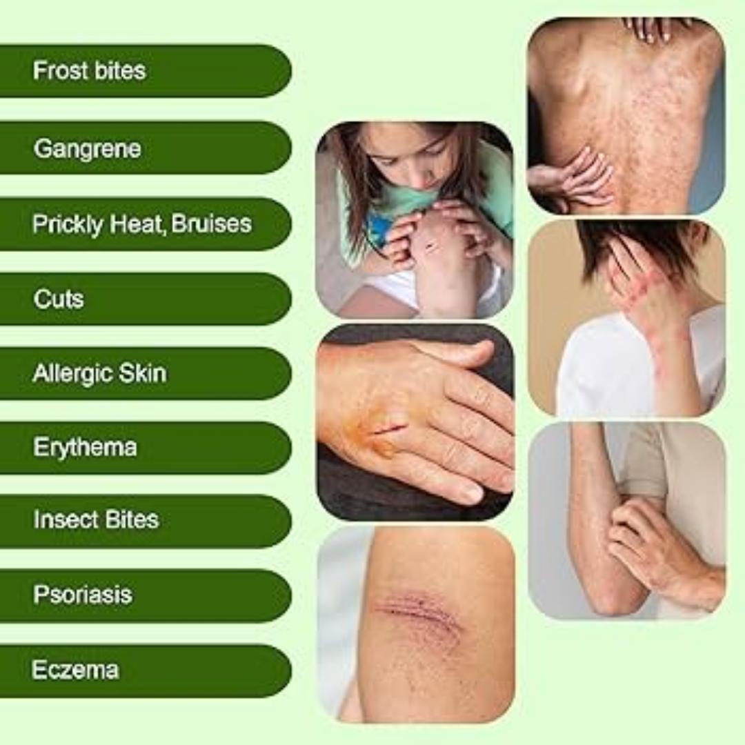 Ebnl Ayurvedic Quiet Cream 50gm | Injury Scars | Surgery Scars | Scar Removal Cream | Keloid Remover | Safe for infants and infants