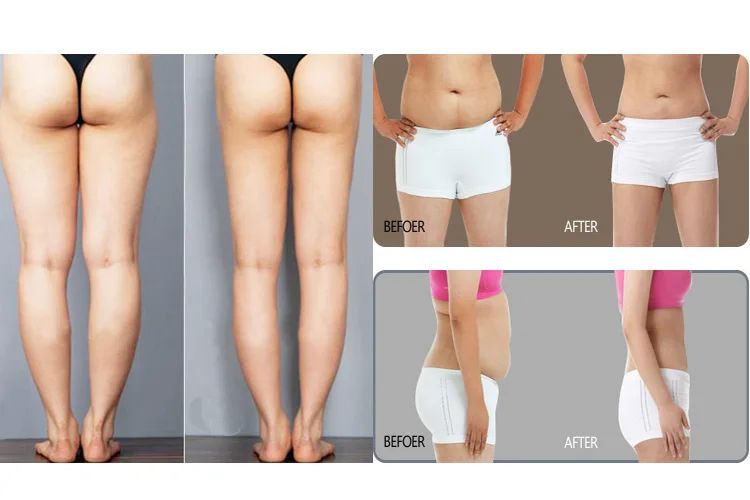 10 /20 /30PCS Weight Loss Navel Sticker Magnetic Slim Detox Adhesive Sheet Fat Burning Slimming Diet Patch Pads Pack Slim Patch Lose Weight Fat Burning White Slim Patch Face Lift Tools Traditional Chi