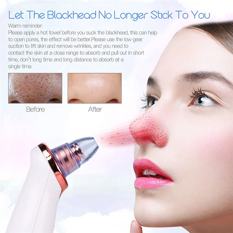 5 in 1 Blackhead Remover Diamond Dermabrasion Nose Vacuum Pore Cleanser Acne Pimple Suction Extractor USB Rechargeable Skin Care Tool