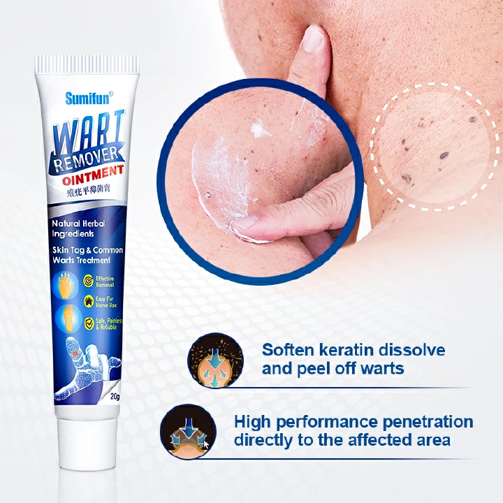 Sumifun Warts Remover Antibacterial Ointment Wart Treatment Cream Skin Tag Remover Herbal Extract Corn Plaster Warts Ointment