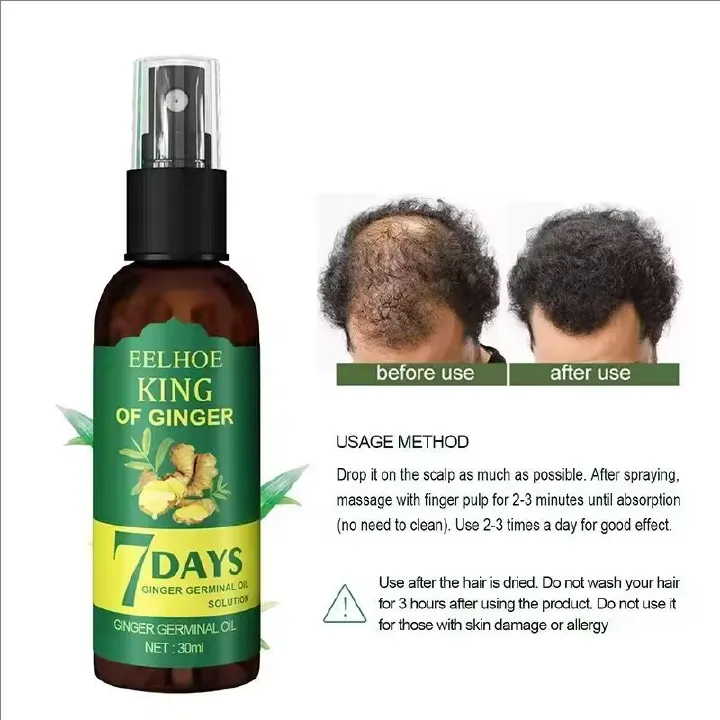 2024 Ginger Hair Growth Serum Sprayer Hair Regrowth s Grow Thicker Longer Hair Accelerate Growth For Men And Women