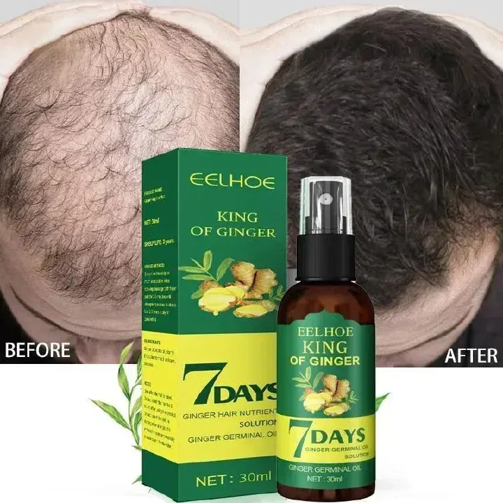 2024 Ginger Hair Growth Serum Sprayer Hair Regrowth s Grow Thicker Longer Hair Accelerate Growth For Men And Women