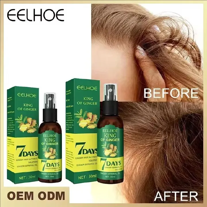 2024 Ginger Hair Growth Serum Sprayer Hair Regrowth s Grow Thicker Longer Hair Accelerate Growth For Men And Women