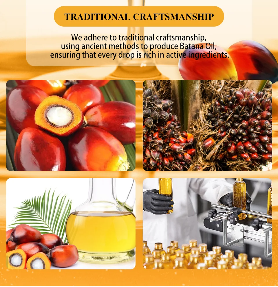 Organic Batana Oil,Natural 100% Pure Batana Growth Oil set For Traction Alopecia Hair Mask Anti Break Loss Hair Growth Oil Baldness Treatment