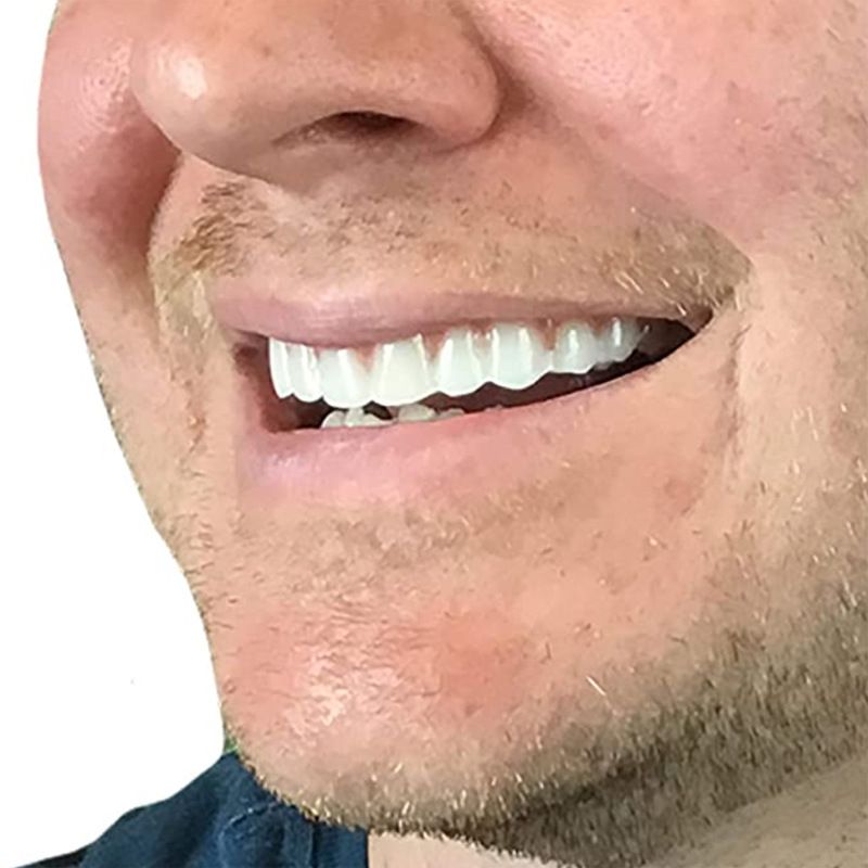 2024 Adult Adjustable Dentures Teeth Set  False Teeth Silicone Upper Lower Veneers Perfect Laugh Veneers Dentures Paste Fake Teeth Braces Comfortable Teeth Orthodontic