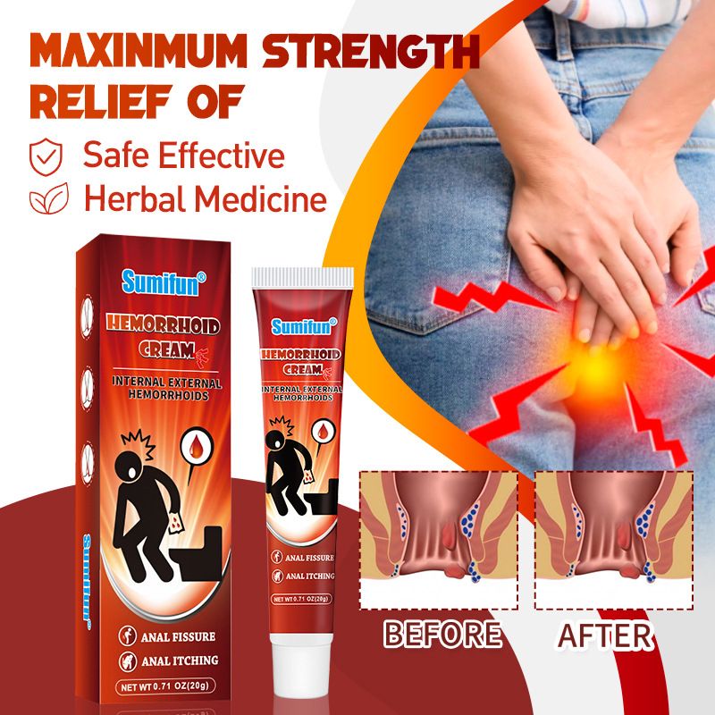 Sumifun Hemorrhoid Cream Ointment Crack Anal Internal External Anal Fissure Painkiller Chinese Herbal Cream Health Care