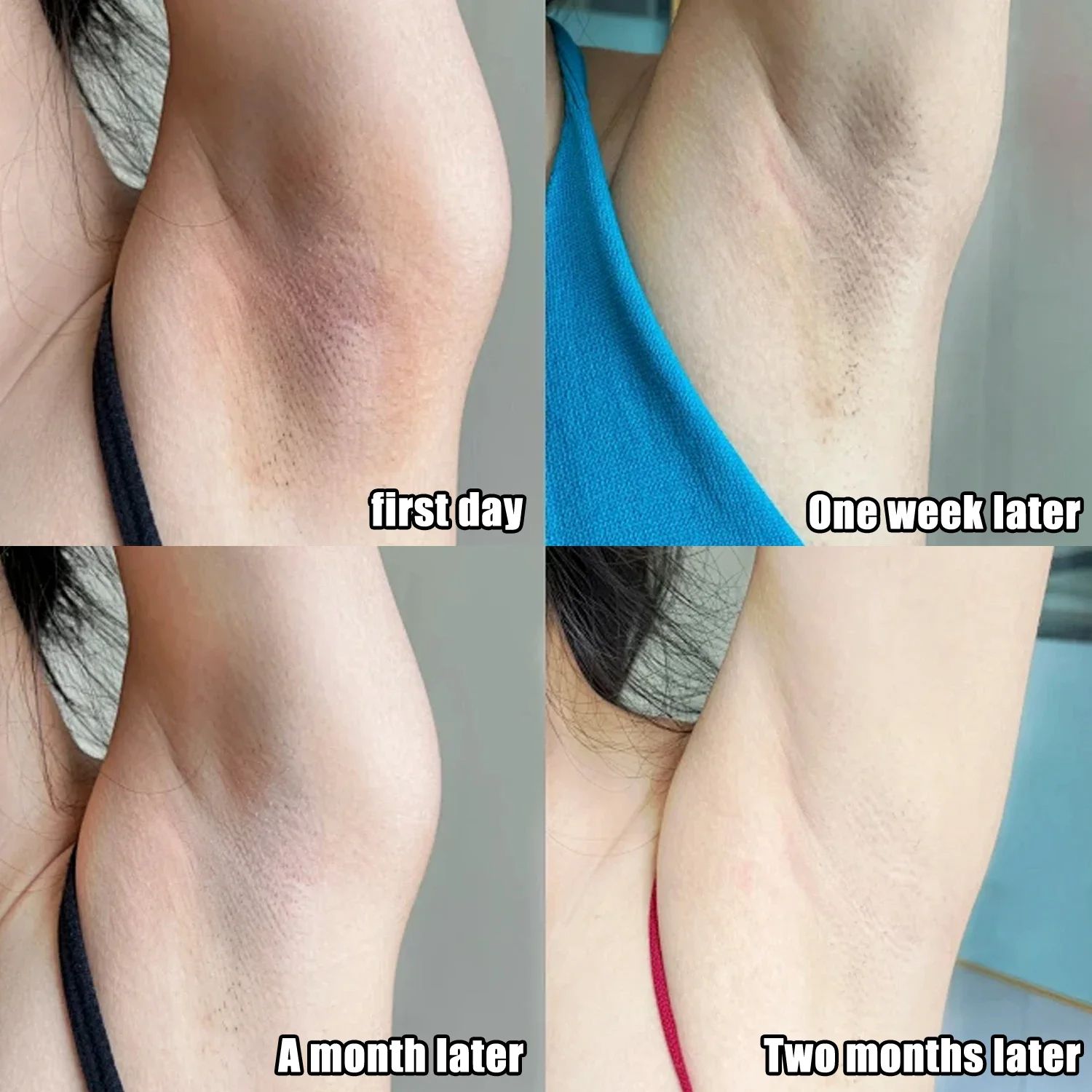 Collagen Underarm Cream Lightening Melanin Moisturizing Kojic Acid Cream Fade Dull Hand Body Elbows Fast Smooth Nourish Lotion