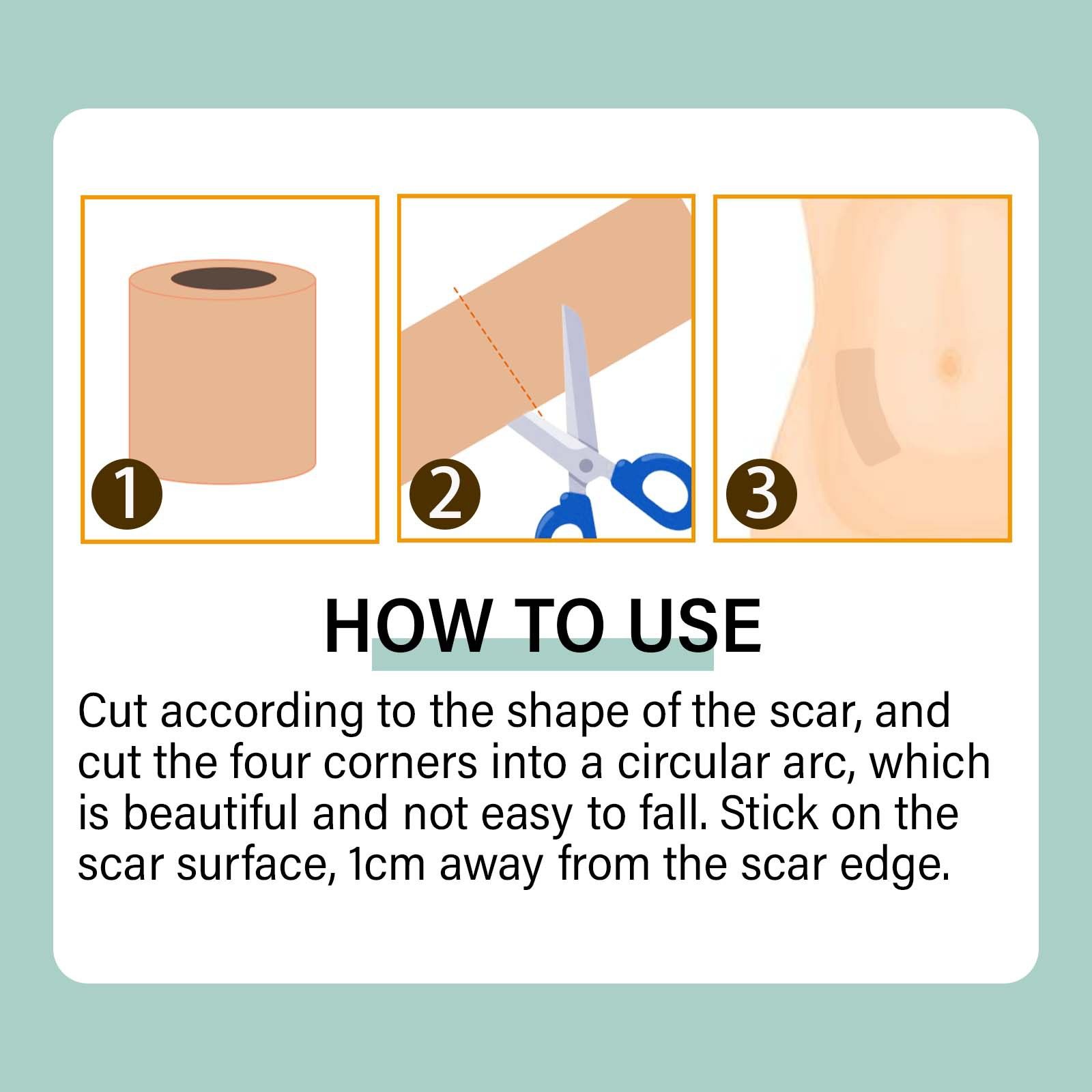 1 Roll  Skin Color Tone Concealer Tattoo Stickers Cover Up Tattoo Burn Scar Birthmark Invisible Patch Waterproof Tape,South moon birthmark skin color concealer cover ,