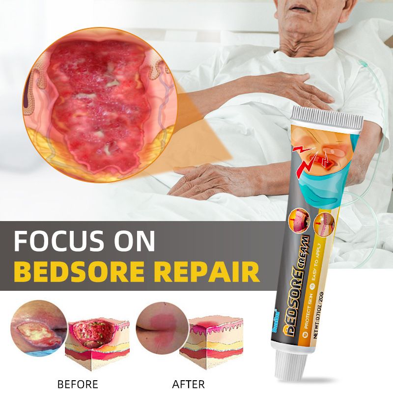 sumifun Bedsore Treatment Cream Pressure Sore Ulcer Skin Rot Necrotic Repair Ointment Bed Sore Wound Healing Decubitus Feet Care Gift