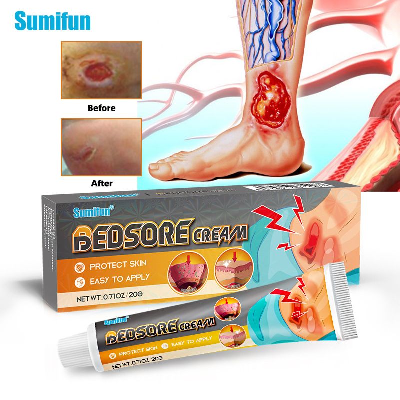 sumifun Bedsore Treatment Cream Pressure Sore Ulcer Skin Rot Necrotic Repair Ointment Bed Sore Wound Healing Decubitus Feet Care Gift