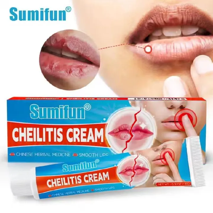 sumifun Cheilitis Cream Inflammation Labial Herpes Antibacterial Ointment Chapped Lips Wrinkles Rehydration