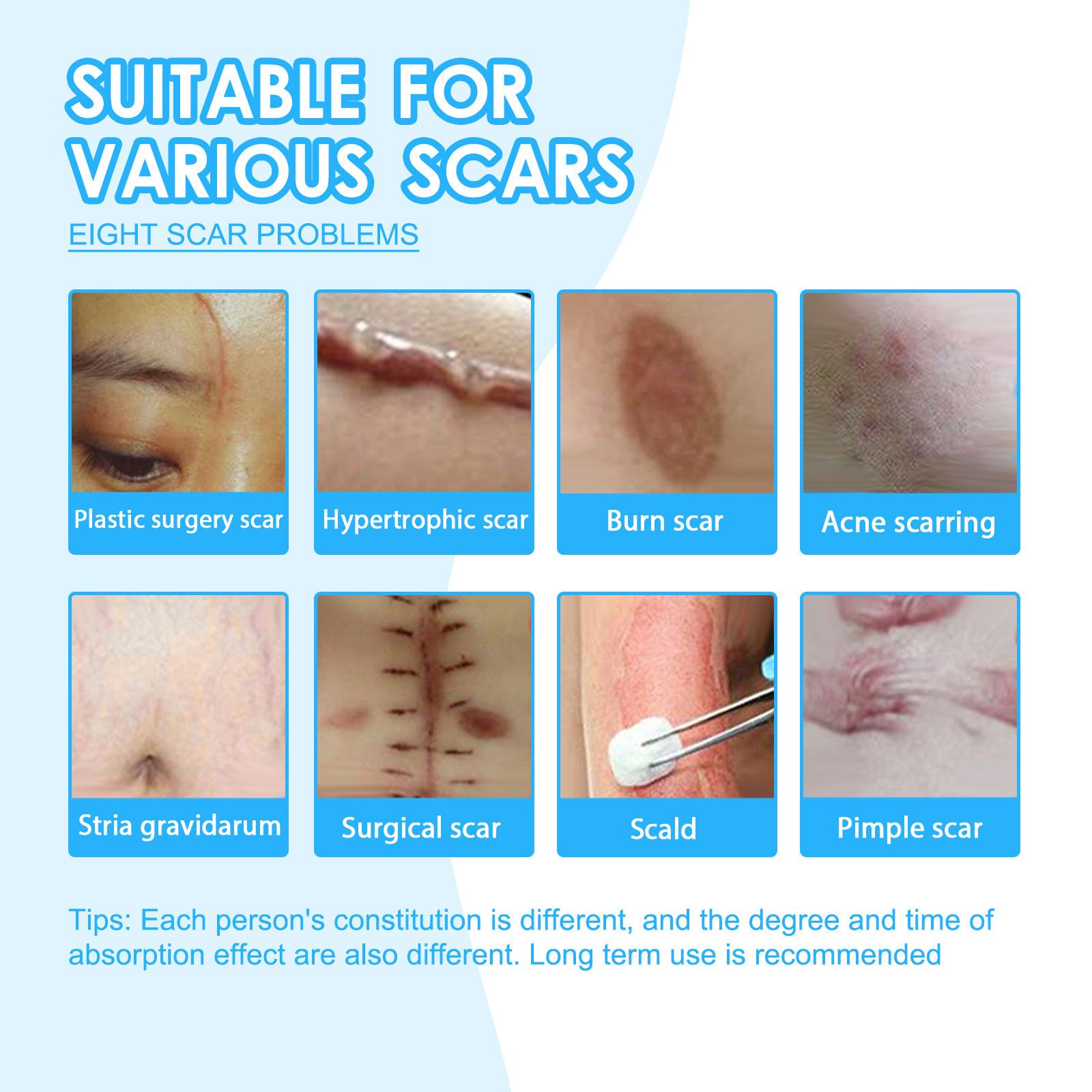Scar Removing Gel Scars Removal Creams For Skin Barrier Repair Scar Removal Cream Scar Gels For Body Skin New And Old Scars