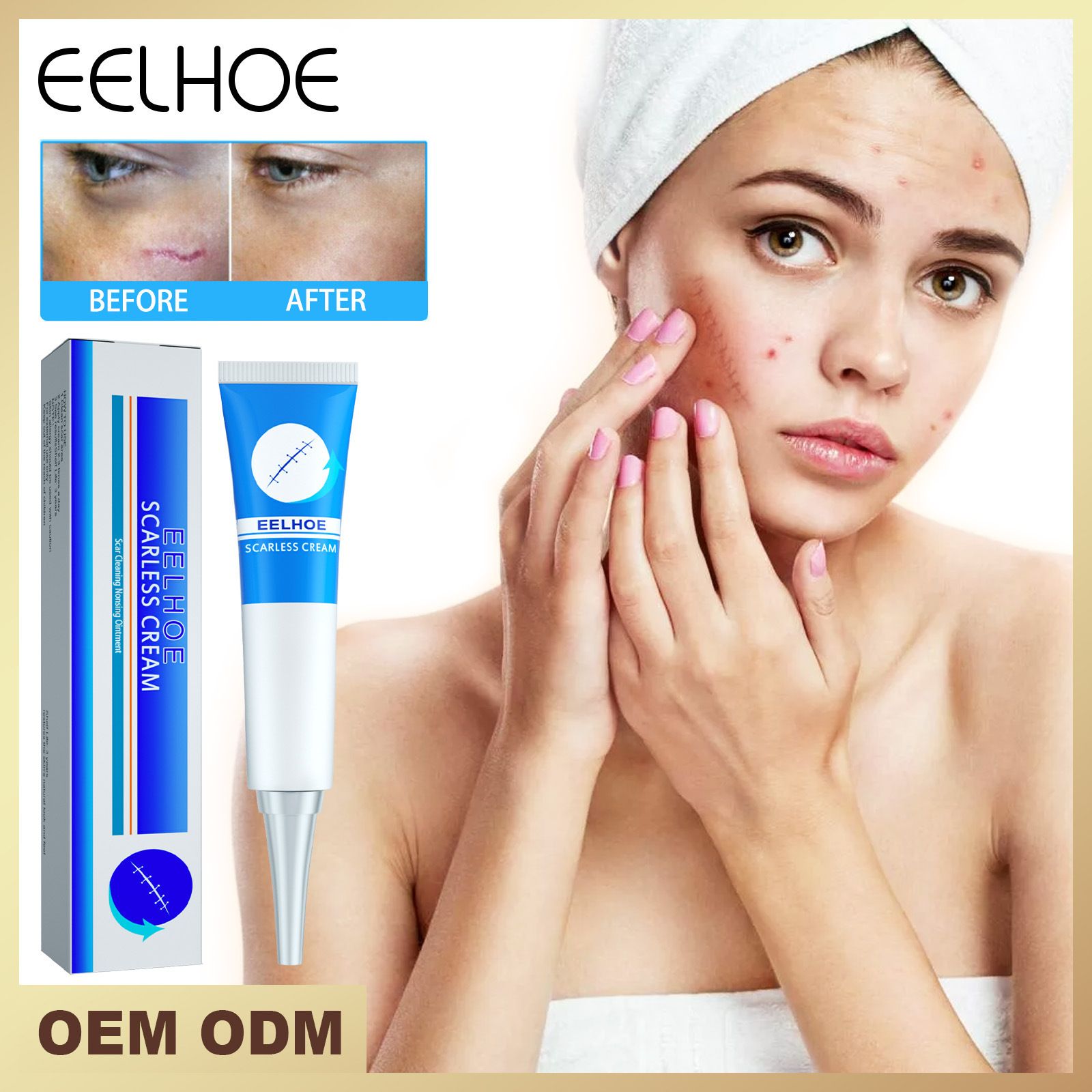 Scar Removing Gel Scars Removal Creams For Skin Barrier Repair Scar Removal Cream Scar Gels For Body Skin New And Old Scars