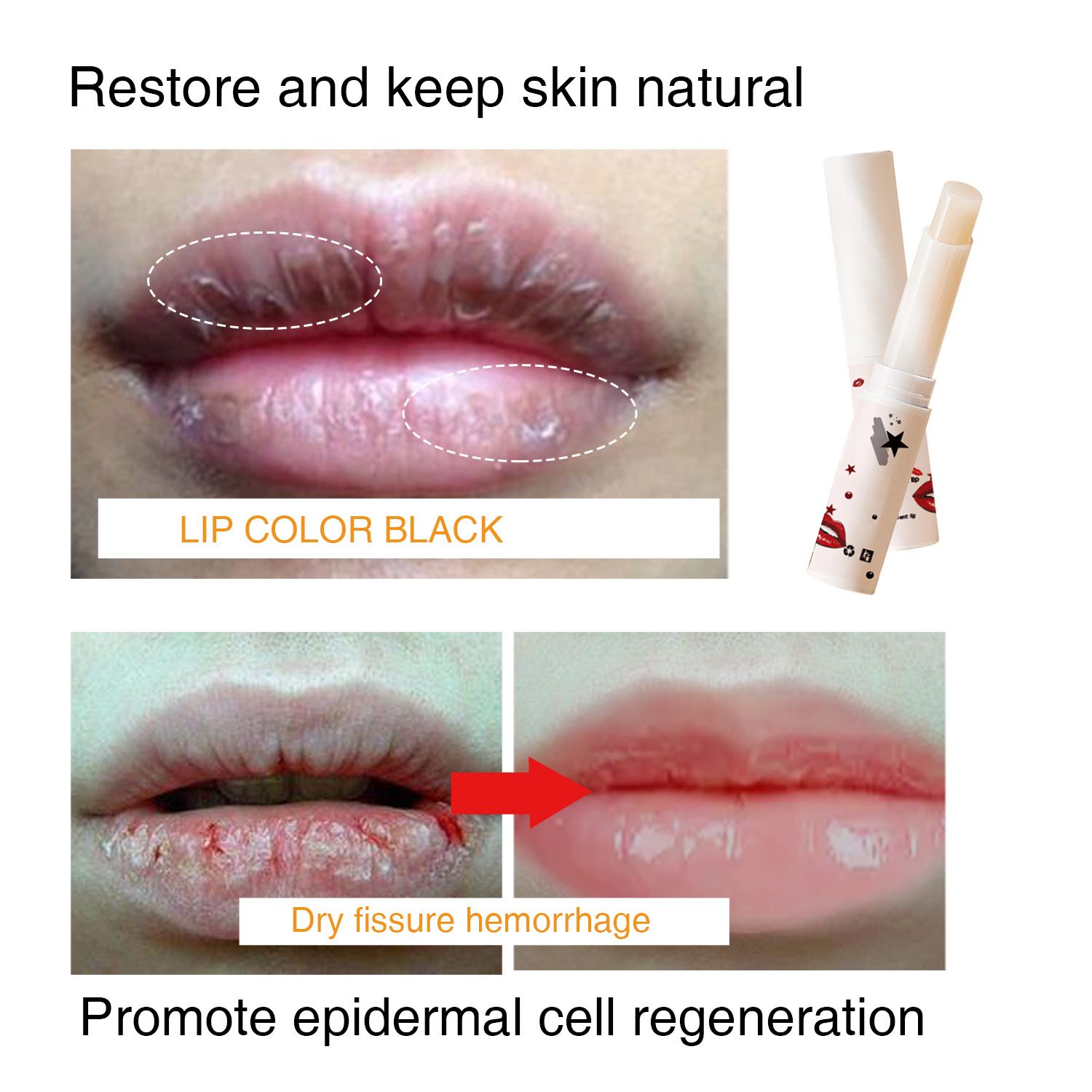 Lips Pink Fresh Lightening Bleaching Cream Treatment Remove Dark Smoke Lips Lip Balm Whitening Moisturizer Nourishing Essence