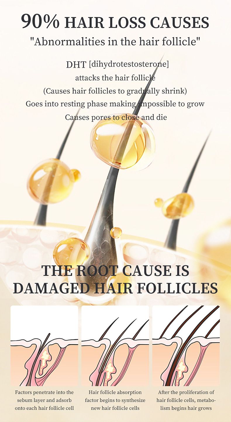 Hair Growth Essential Oil Anti Hair Loss Hair Fiber Nutrition Biotin Hair Thinning Treatment Nourishing Hair Regrowth Serum