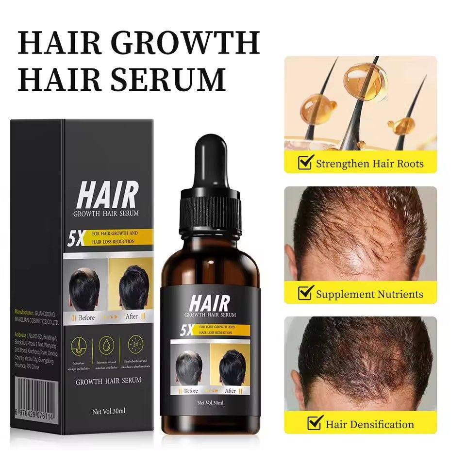 Hair Growth Essential Oil Anti Hair Loss Hair Fiber Nutrition Biotin Hair Thinning Treatment Nourishing Hair Regrowth Serum