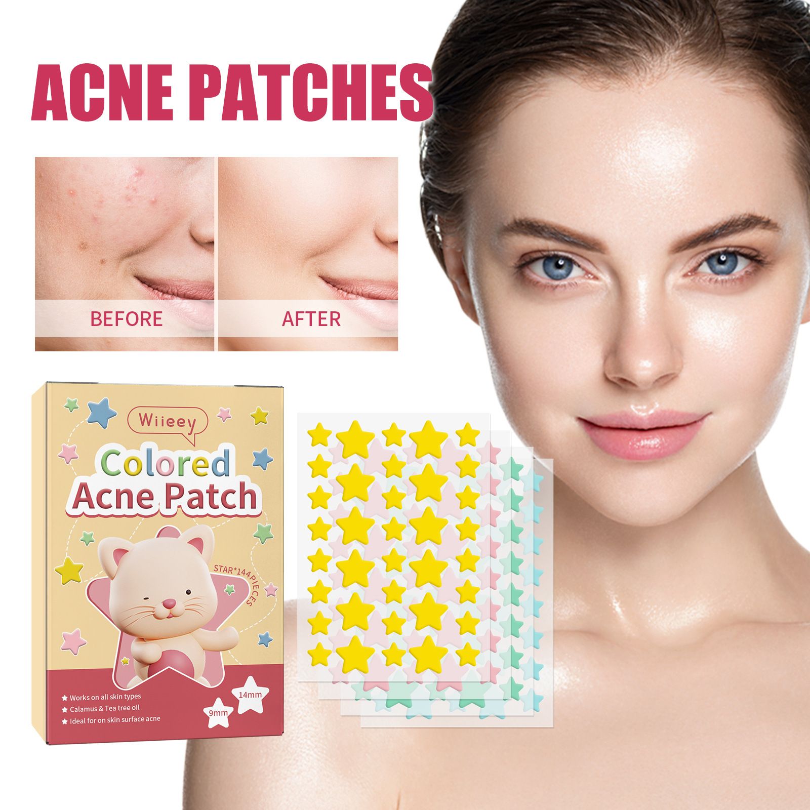 144PCS Star Pimple Patch Acne Colorful Invisible Acne Removal Skin Care Stickers Concealer Face Spot Beauty Makeup Tools