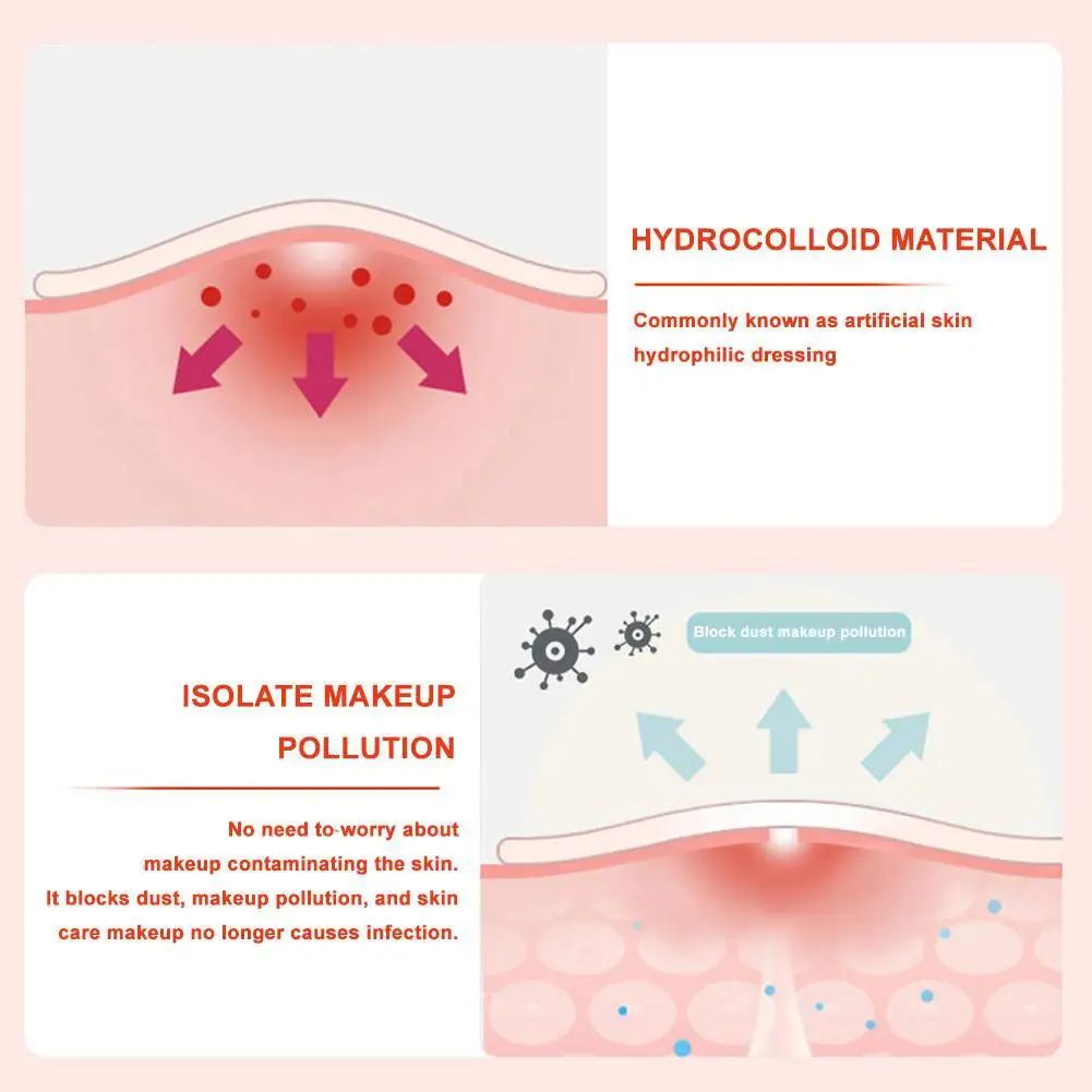 600pcs Invisible Waterproof Acne Patch Reduce Pimples Blackheads Mild Non-irritating Concealer Face Spot Skin Care Tools