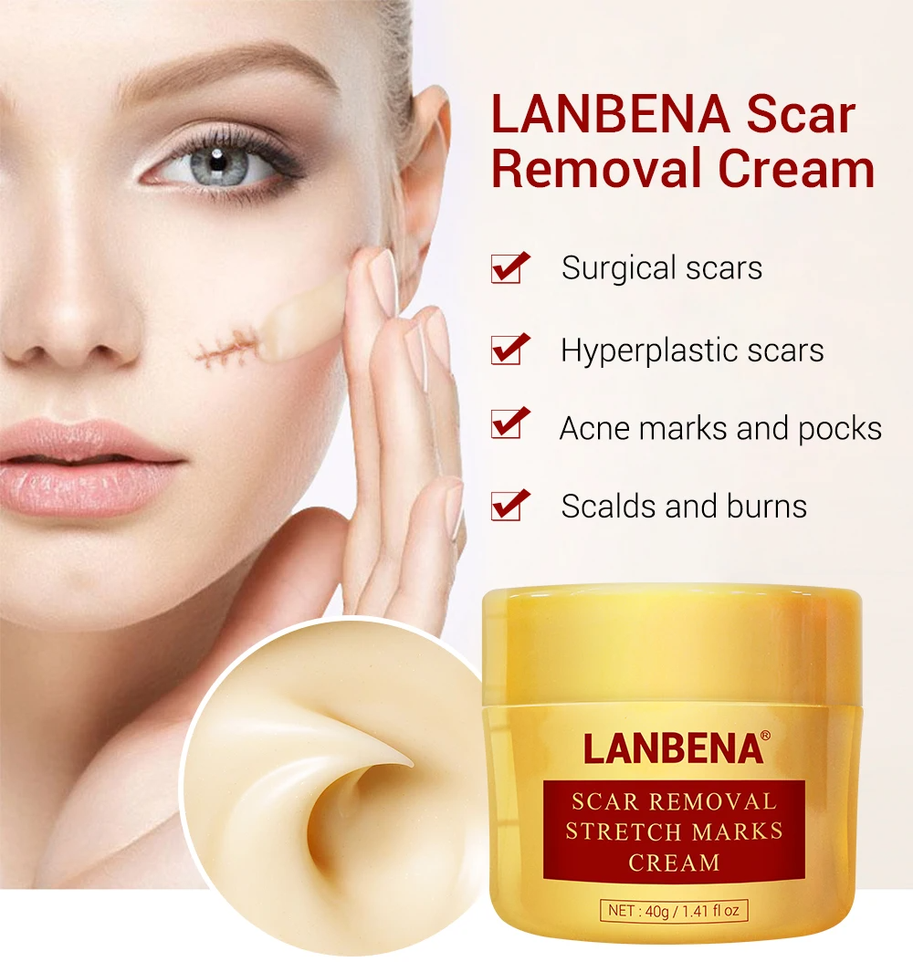 LANBENA Acne Scar Removal Cream Stretch Marks Repair Cream Face Acne Spots Treatment Blackhead Whitening Shrink Pores Skin Care