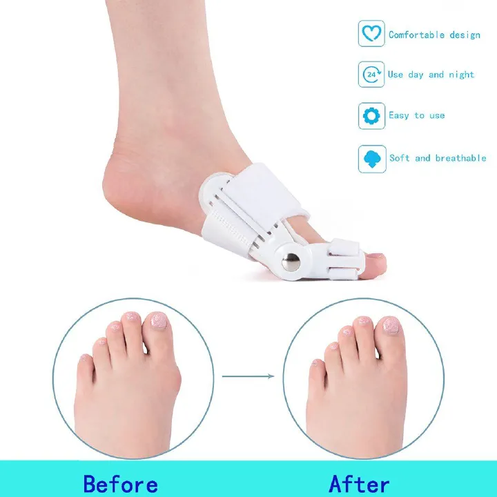 1PC orthopedic correction device ,Big Bone Toe Bunion Splint Straightener Corrector Foot Pain Relief Hallux Valgus Feet Care Protector Foot Care Tools